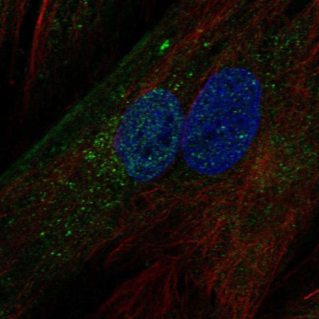 IGFBP5 Antibody in Immunocytochemistry (ICC/IF)