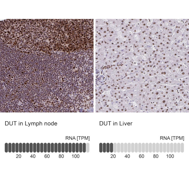 DUT Antibody in Immunohistochemistry (Paraffin) (IHC (P))