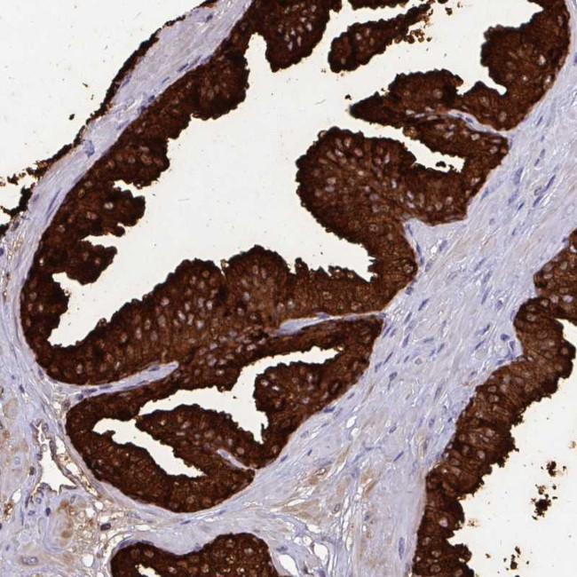 OR10R2 Antibody in Immunohistochemistry (Paraffin) (IHC (P))