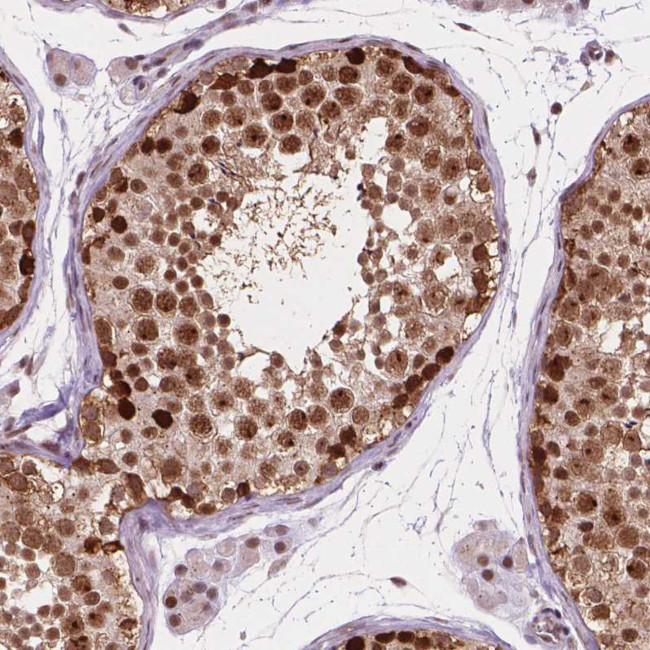 PER2 Antibody in Immunohistochemistry (Paraffin) (IHC (P))