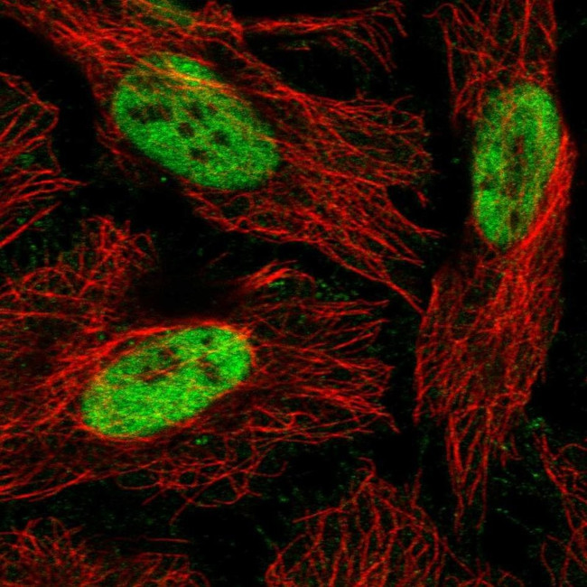 RbAp48 Antibody in Immunocytochemistry (ICC/IF)