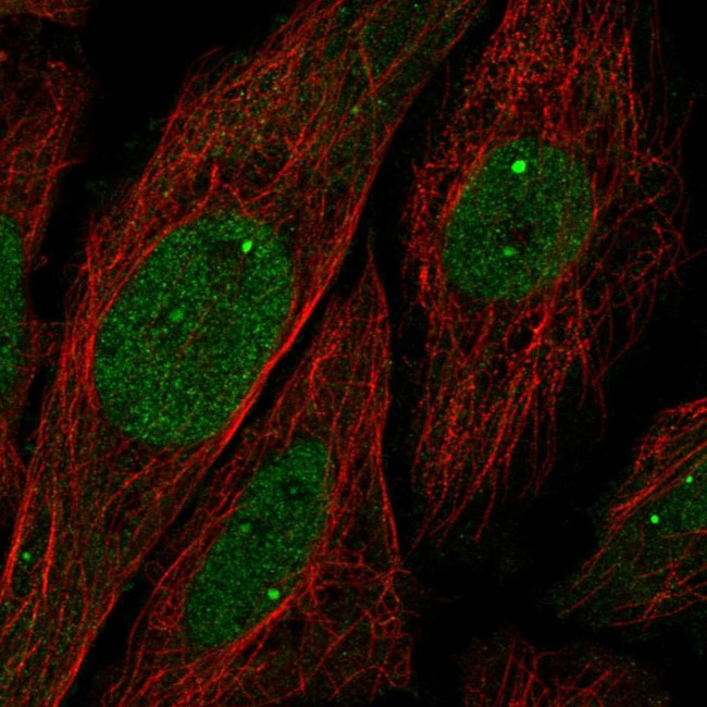 Ubinuclein 1 Antibody in Immunocytochemistry (ICC/IF)