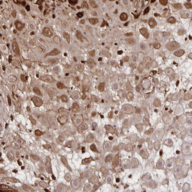 Noggin Antibody in Immunohistochemistry (Paraffin) (IHC (P))