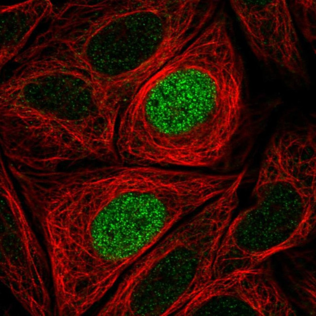 PHLDB1 Antibody in Immunocytochemistry (ICC/IF)