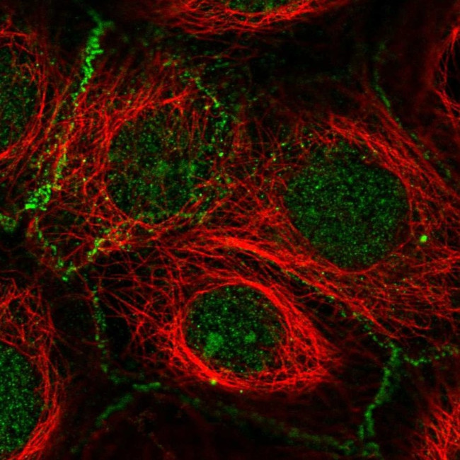 FBXL2 Antibody in Immunocytochemistry (ICC/IF)