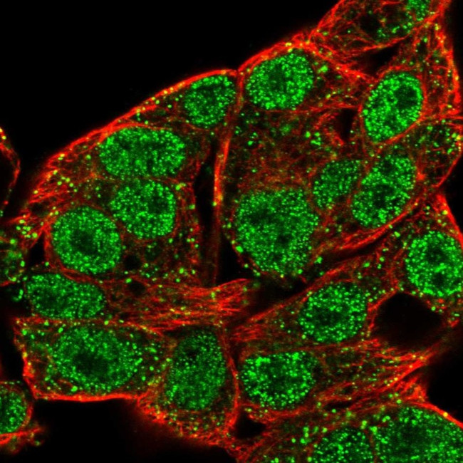 STK39 Antibody in Immunocytochemistry (ICC/IF)