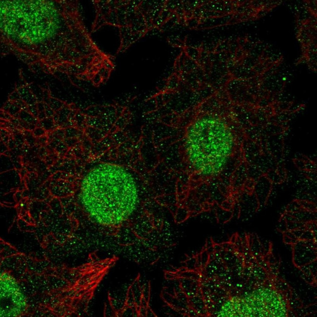 SMAD6 Antibody in Immunocytochemistry (ICC/IF)