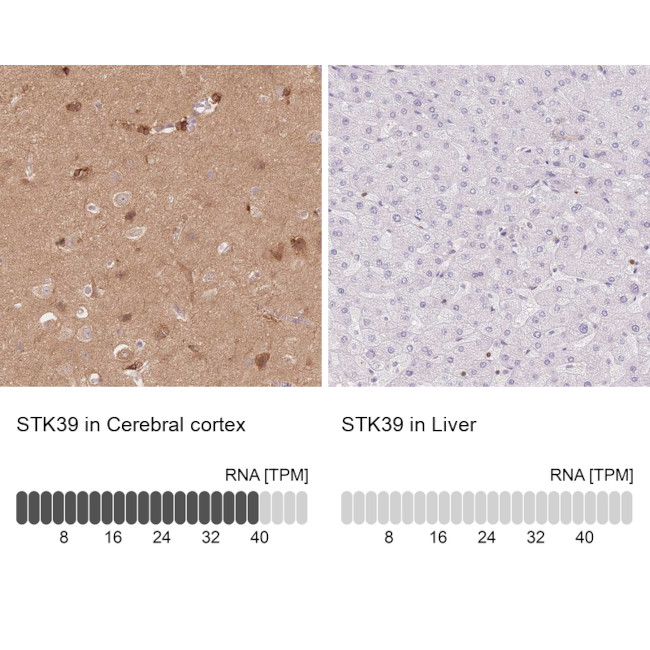 STK39 Antibody in Immunohistochemistry (Paraffin) (IHC (P))