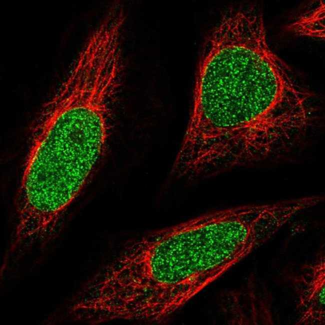 ABCA5 Antibody in Immunocytochemistry (ICC/IF)