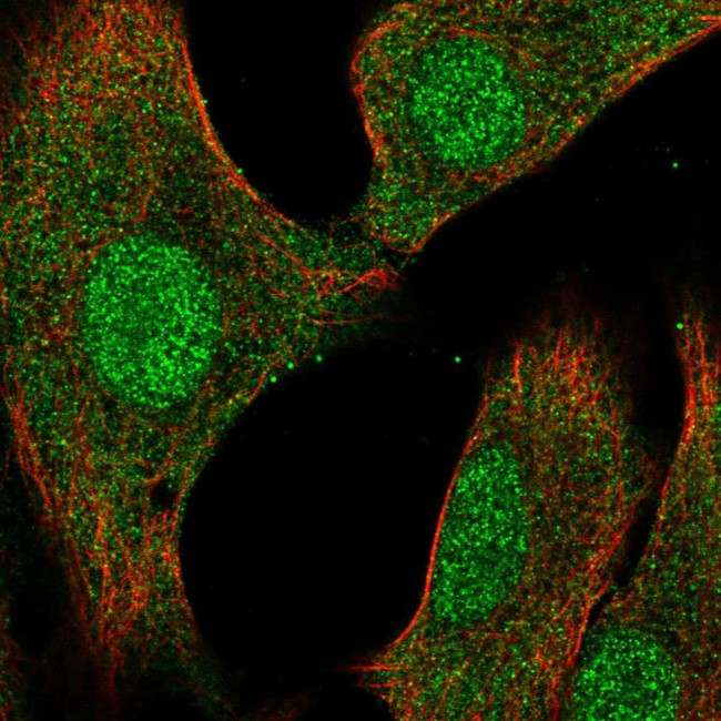 DUSP3 Antibody in Immunocytochemistry (ICC/IF)