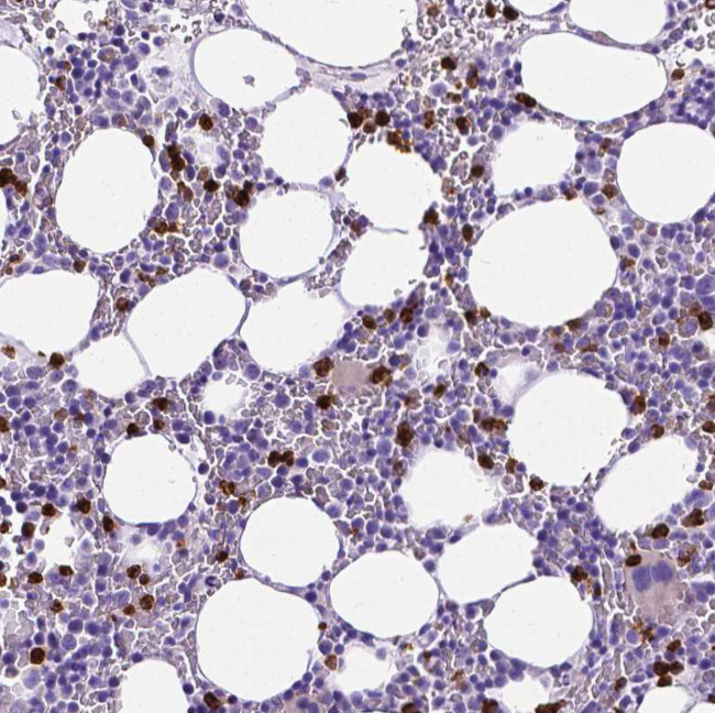 MMP9 Antibody in Immunohistochemistry (Paraffin) (IHC (P))