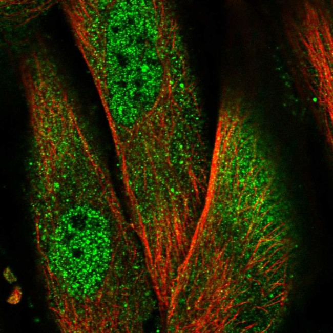 NALP1 Antibody in Immunocytochemistry (ICC/IF)