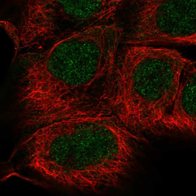 SGPP1 Antibody in Immunocytochemistry (ICC/IF)