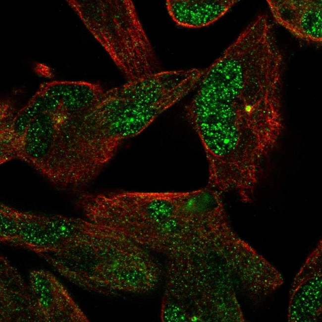 NEK2 Antibody in Immunocytochemistry (ICC/IF)