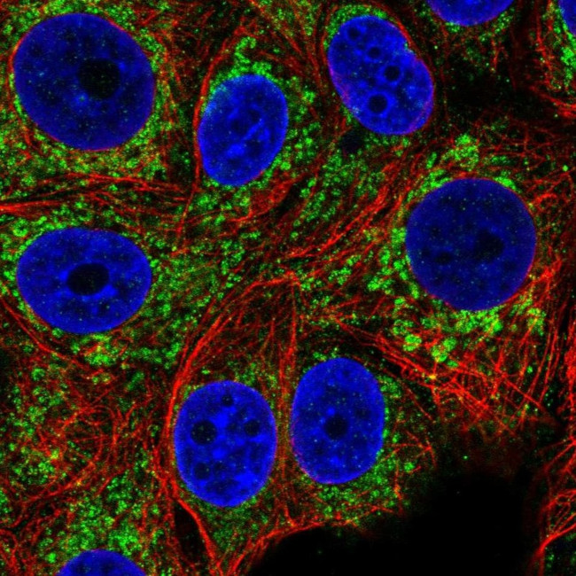 CCM2 Antibody in Immunocytochemistry (ICC/IF)