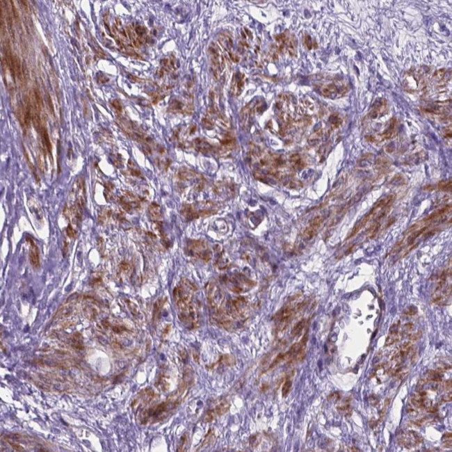 PFKFB4 Antibody in Immunohistochemistry (Paraffin) (IHC (P))