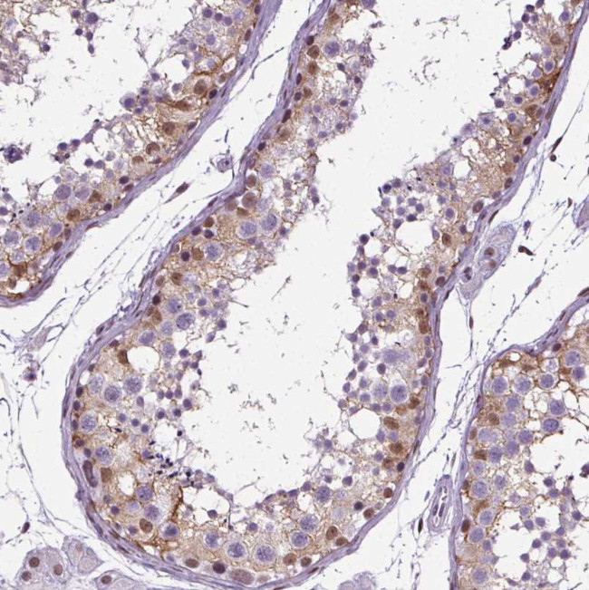 GP6 Antibody in Immunohistochemistry (Paraffin) (IHC (P))