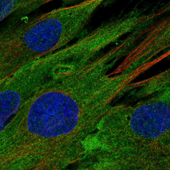 EphB1 Antibody in Immunocytochemistry (ICC/IF)