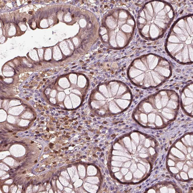 IL31RA Antibody in Immunohistochemistry (Paraffin) (IHC (P))