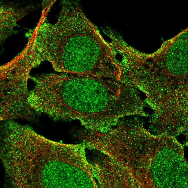 BCORL1 Antibody in Immunocytochemistry (ICC/IF)