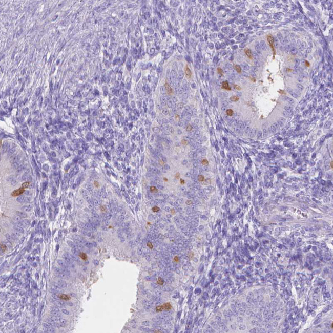 MMP11 Antibody in Immunohistochemistry (Paraffin) (IHC (P))