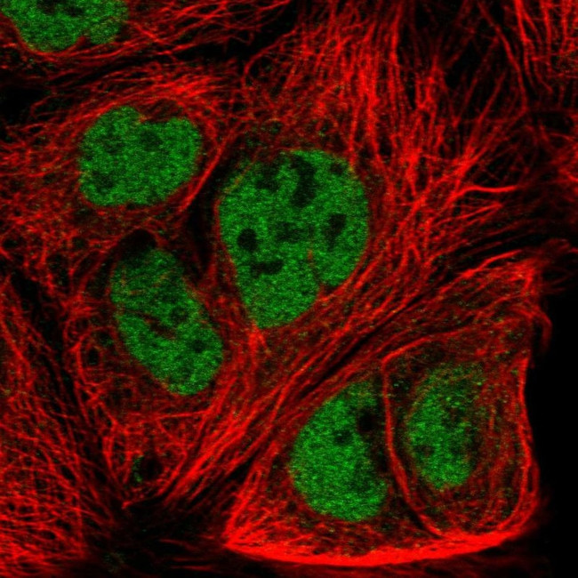 FZD7 Antibody in Immunocytochemistry (ICC/IF)