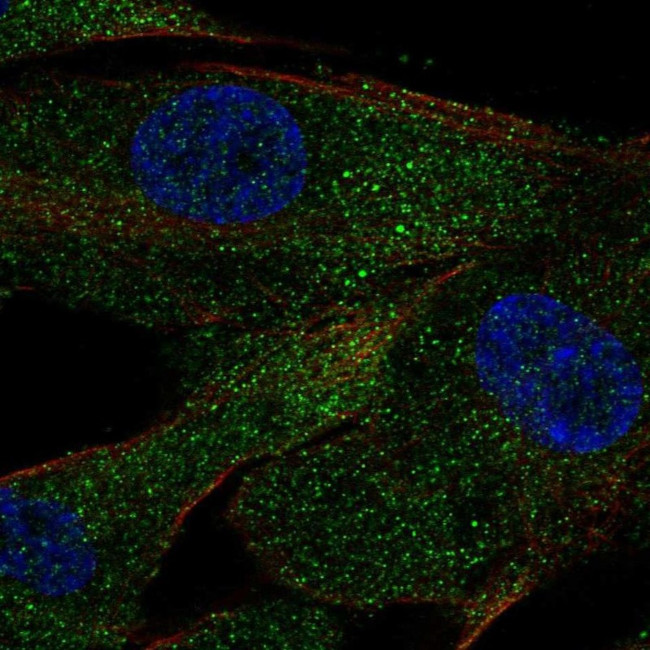 ACE Antibody in Immunocytochemistry (ICC/IF)