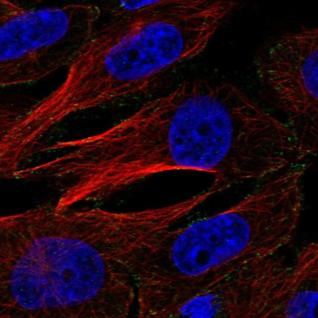 AP2M1 Antibody in Immunocytochemistry (ICC/IF)