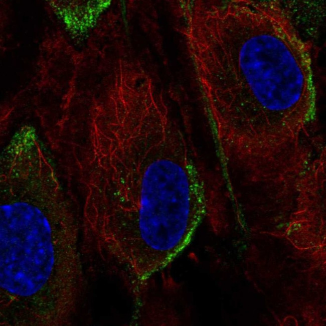 PIK3CG Antibody in Immunocytochemistry (ICC/IF)