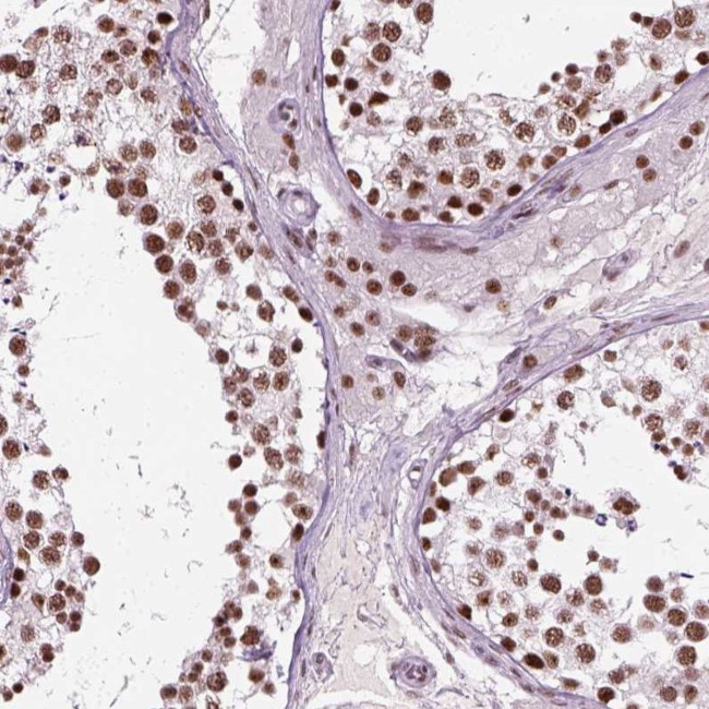 GTF2F1 Antibody in Immunohistochemistry (Paraffin) (IHC (P))