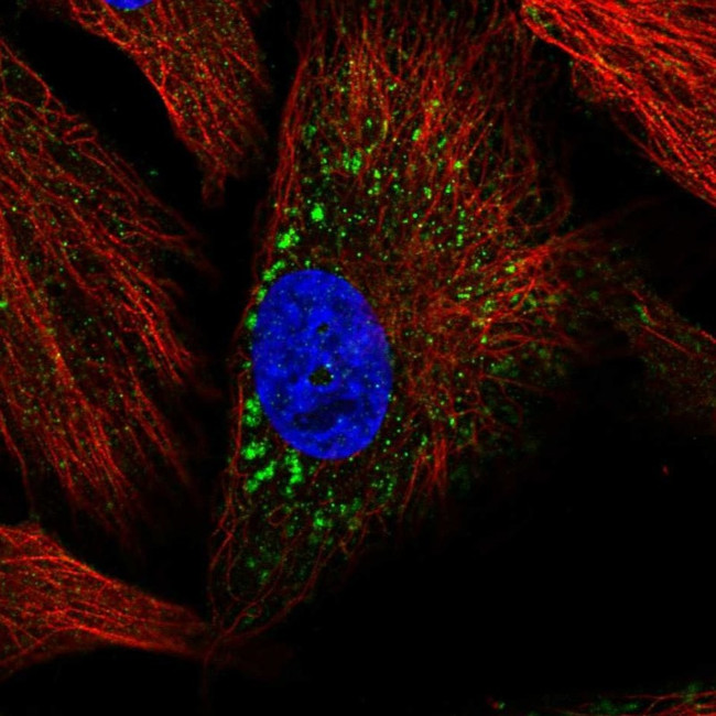 MMP19 Antibody in Immunocytochemistry (ICC/IF)