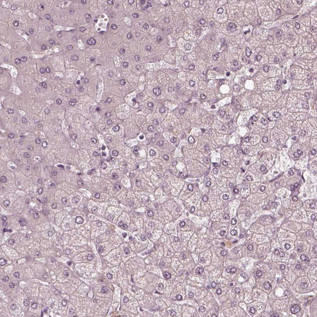 Fibulin 3 Antibody in Immunohistochemistry (Paraffin) (IHC (P))