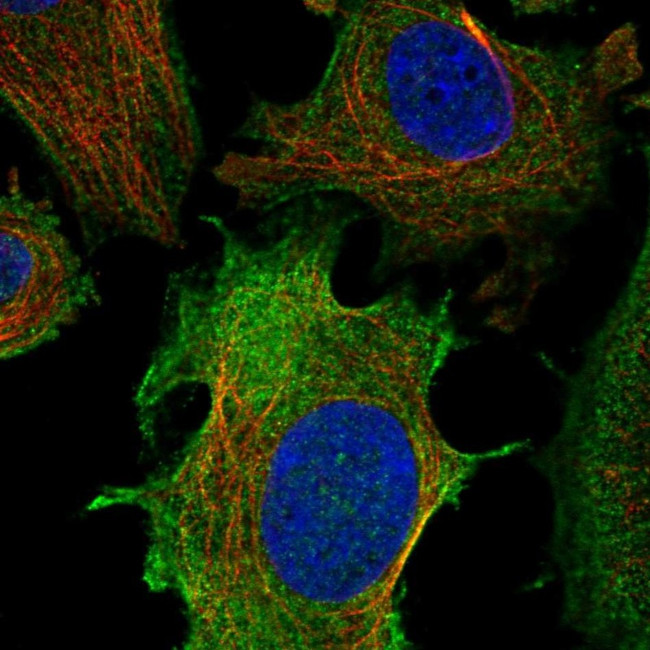 ULBP1 Antibody in Immunocytochemistry (ICC/IF)