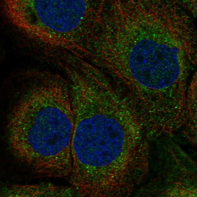 TAP1 Antibody in Immunocytochemistry (ICC/IF)