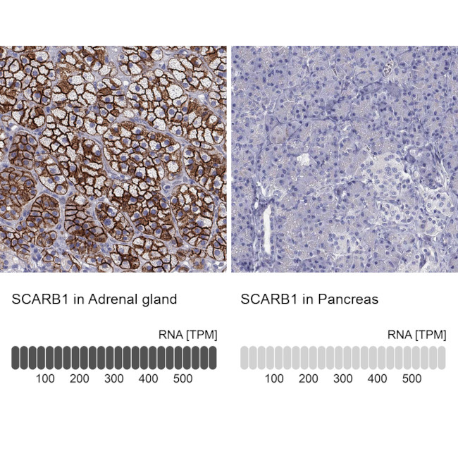 SR-BI Antibody in Immunohistochemistry (Paraffin) (IHC (P))