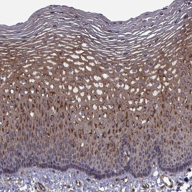 TRIP10 Antibody in Immunohistochemistry (Paraffin) (IHC (P))