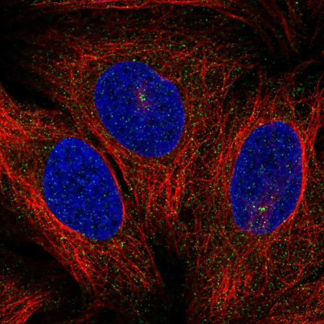 PKC theta Antibody in Immunocytochemistry (ICC/IF)