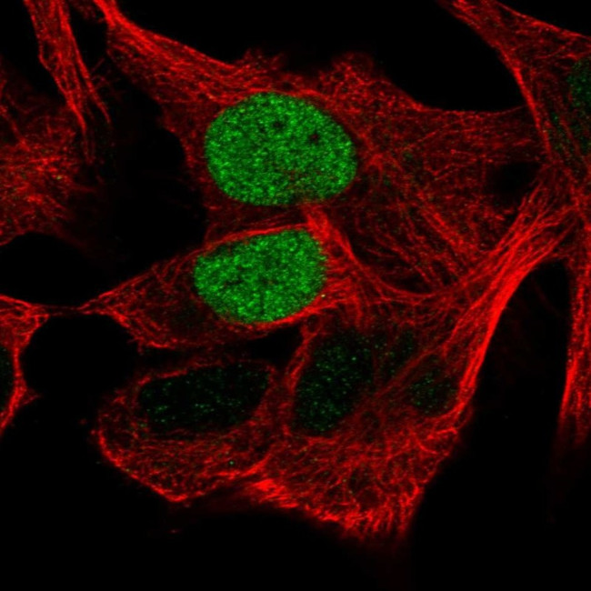 OCT6 Antibody in Immunocytochemistry (ICC/IF)