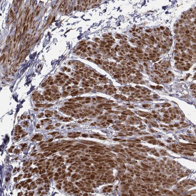 TRIP10 Antibody in Immunohistochemistry (Paraffin) (IHC (P))