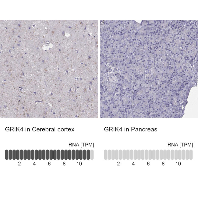 GRIK4 Antibody in Immunohistochemistry (Paraffin) (IHC (P))