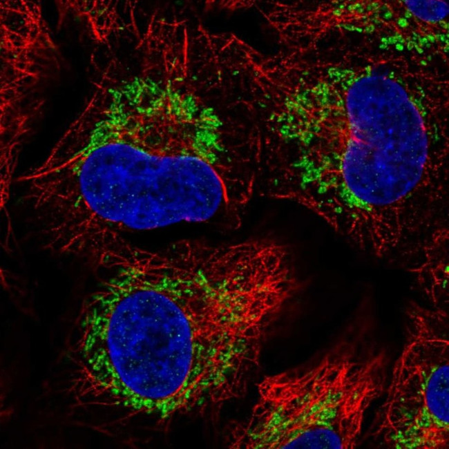 CCR7 Antibody in Immunocytochemistry (ICC/IF)