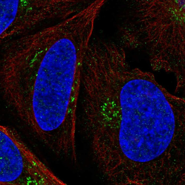 PTCH Antibody in Immunocytochemistry (ICC/IF)