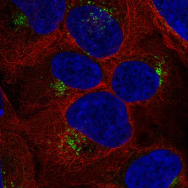 RYK Antibody in Immunocytochemistry (ICC/IF)