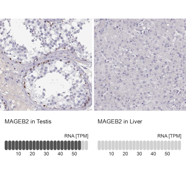 MAGEB2 Antibody in Immunohistochemistry (Paraffin) (IHC (P))