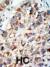 UBA2 Antibody in Immunohistochemistry (Paraffin) (IHC (P))