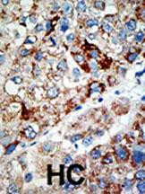 USP21 Antibody in Immunohistochemistry (Paraffin) (IHC (P))