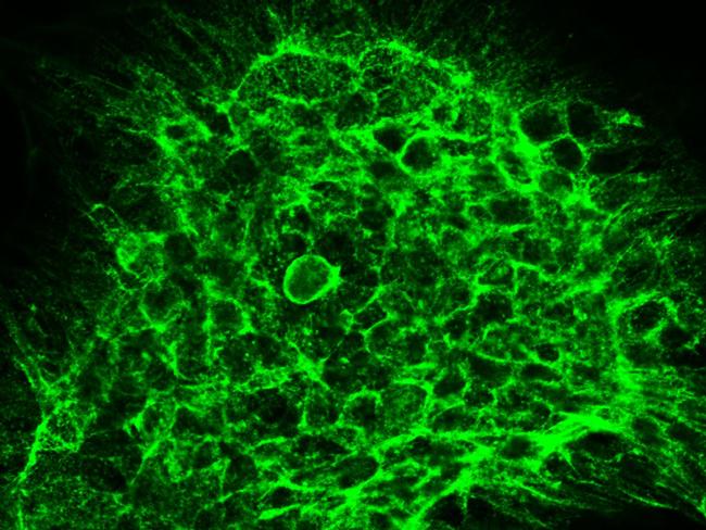 CCR1 Antibody in Immunocytochemistry (ICC/IF)