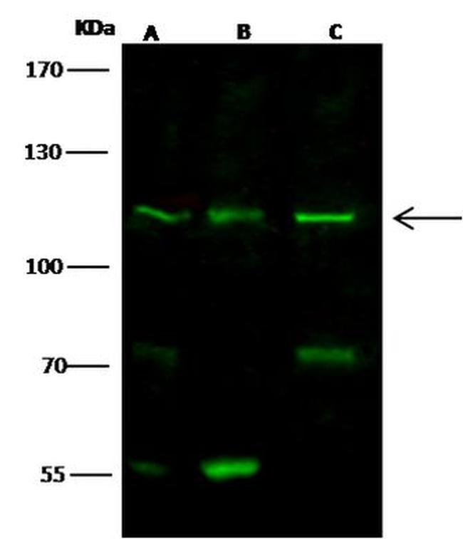 Desmoglein 1 Antibody in Western Blot (WB)