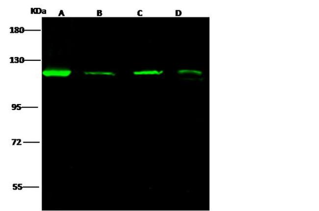 AP2A2 Antibody in Western Blot (WB)