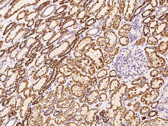 DLAT Antibody in Immunohistochemistry (Paraffin) (IHC (P))